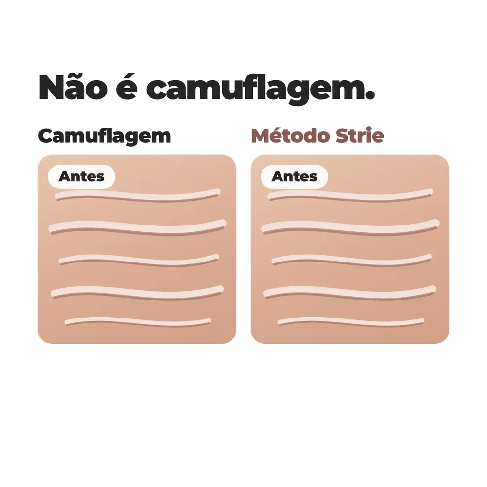 Animação de antes e depois. Na camuflagem, o pigmento disfarça a cor, mas o relevo da estria continua. No Método Strie, sem pigmento, a pele fica com textura e cor mais uniformes.